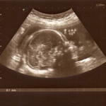 quiz-embryon-foetus-1
